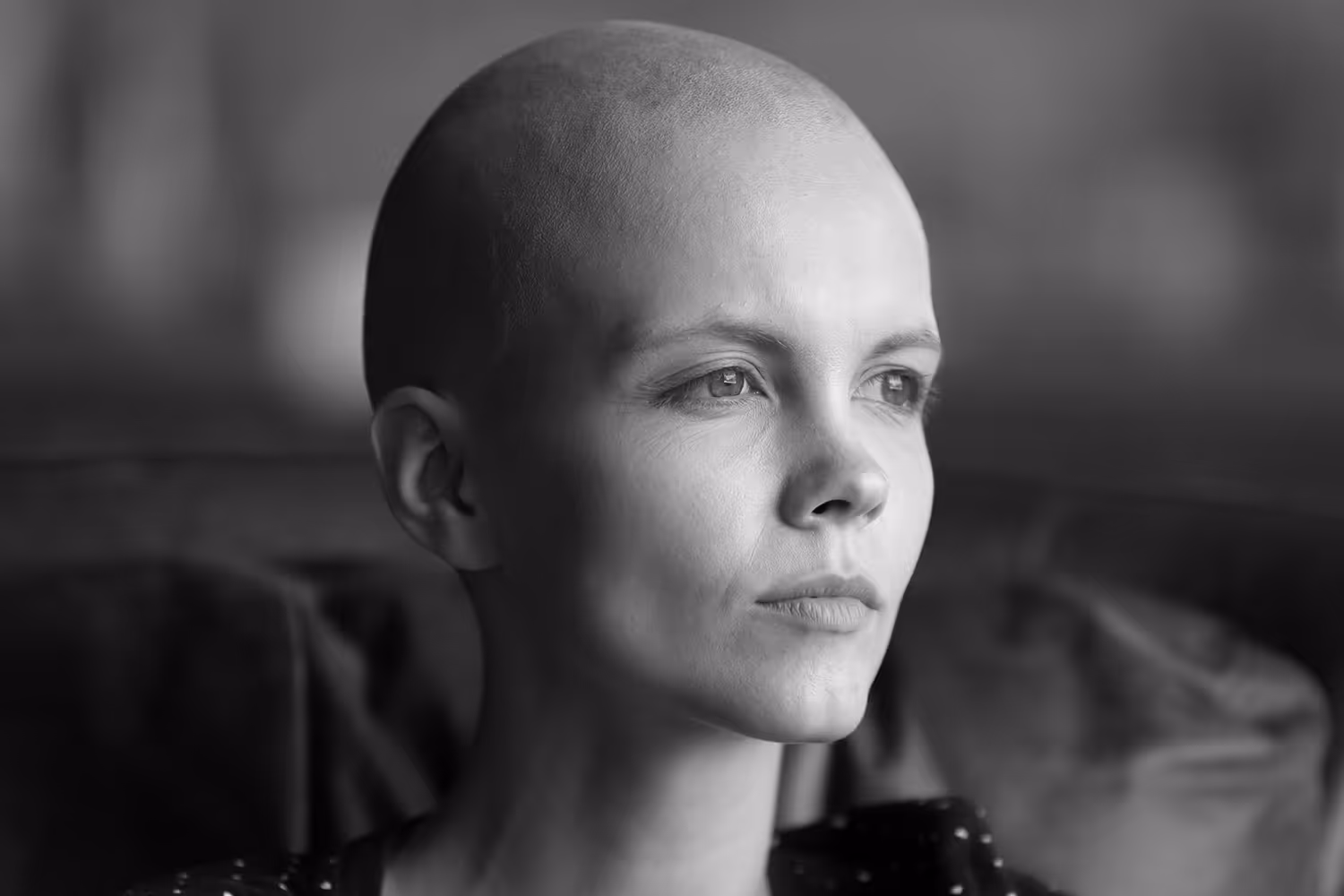 Woman with shaved head from cancer